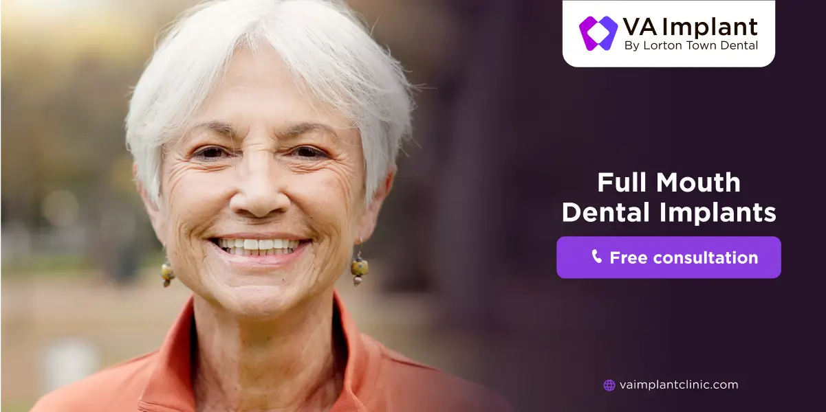 full mouth dental implant