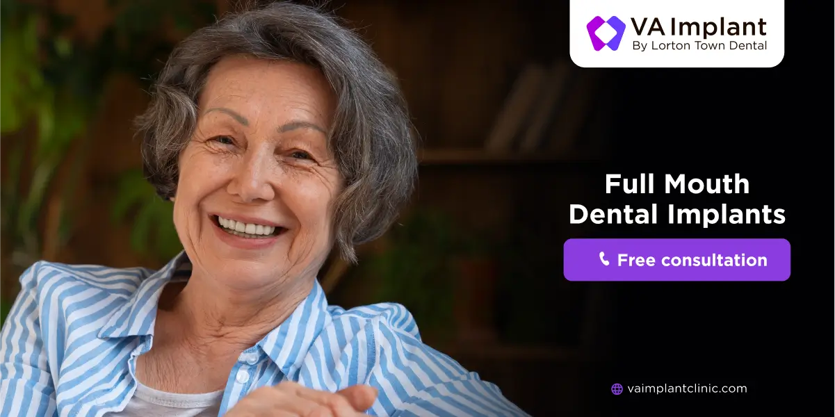 full mouth dental implant