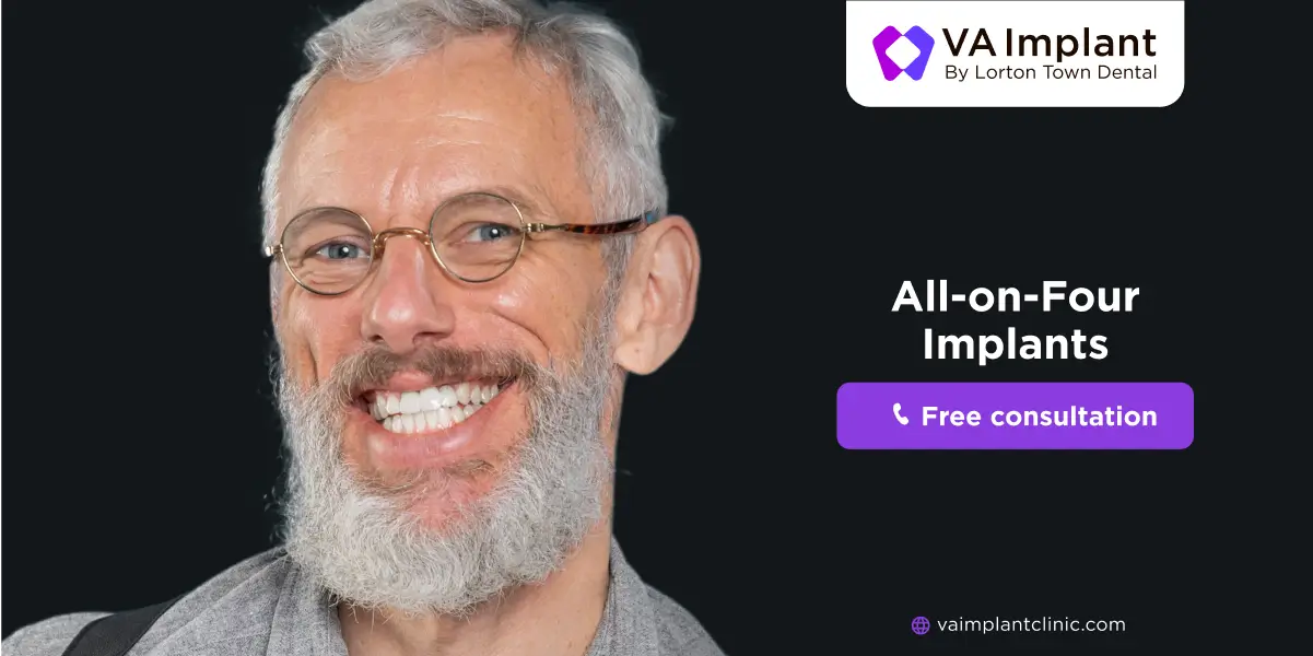 How to Care for your All on 4 Dental Implants