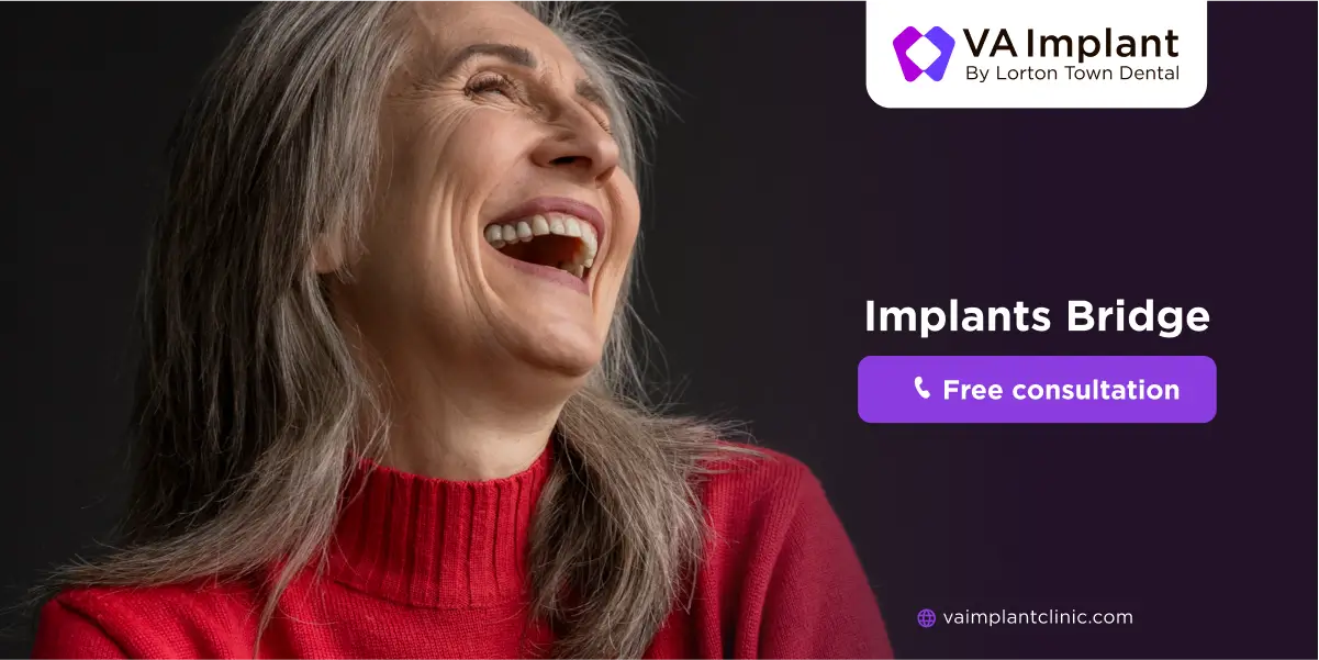 implant bridge