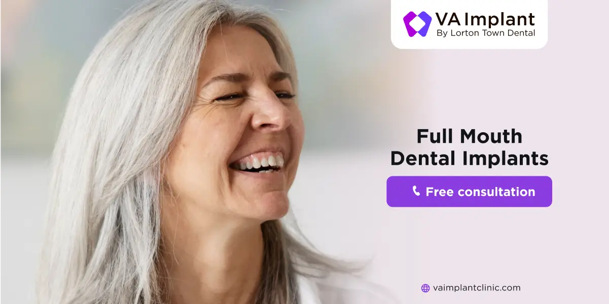 full mouth dental implants in Virginia