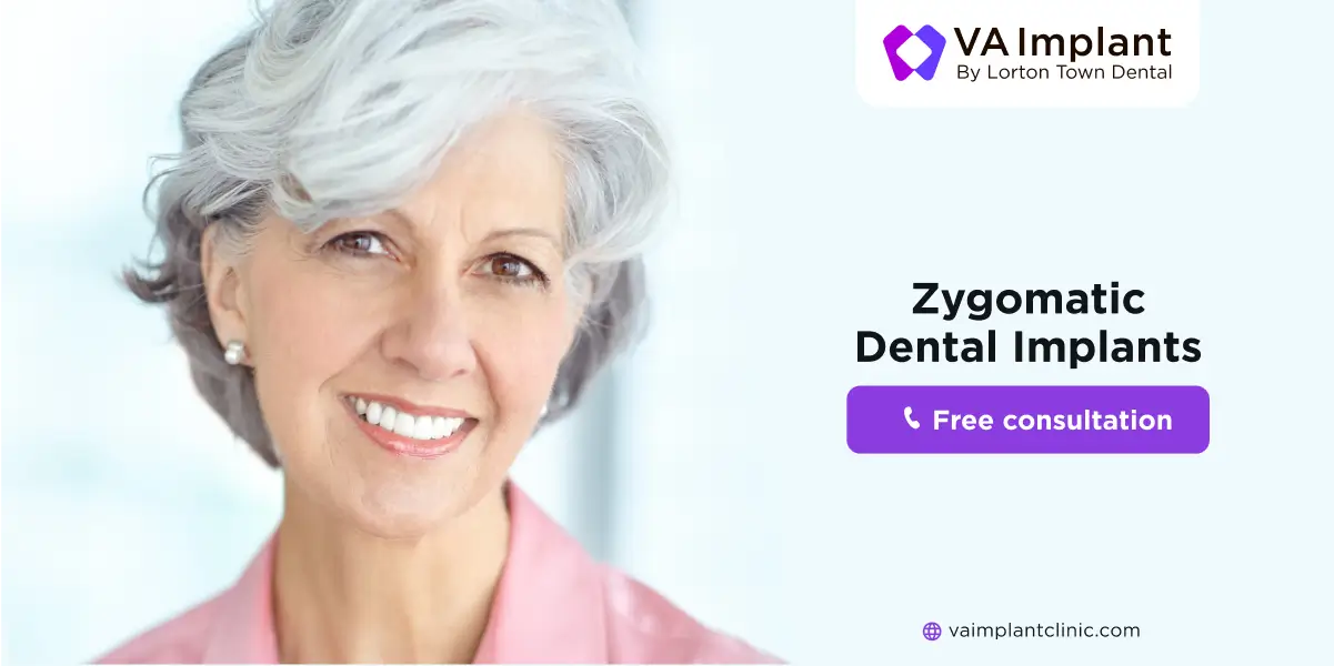 zygomatic dental implants